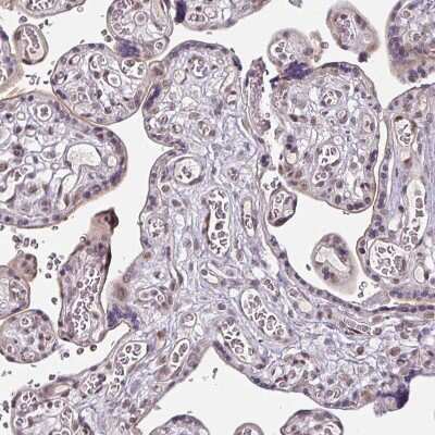 Immunohistochemistry-Paraffin: SLC5A5/Sodium Iodide Symporter Antibody [NBP2-33547]