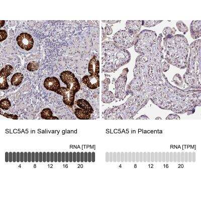 Immunohistochemistry-Paraffin: SLC5A5/Sodium Iodide Symporter Antibody [NBP2-33547]