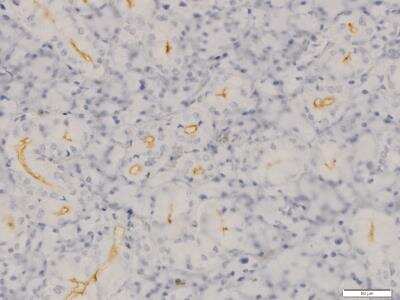 Immunohistochemistry-Paraffin: SLC5A5/Sodium Iodide Symporter Antibody [NBP2-33547]