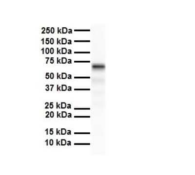 Western Blot: SLC5A5/Sodium Iodide Symporter Antibody [NBP1-59851]