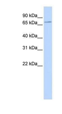 Western Blot: SLC5A5/Sodium Iodide Symporter Antibody [NBP1-62517]