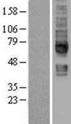 Western Blot: SMVT/SLC5A6 Overexpression Lysate [NBL1-16175]