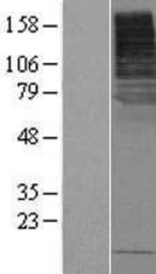 Western Blot: SLC5A8/SMCT1 Overexpression Lysate [NBP2-05447]