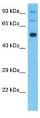 Western Blot: SLC5A8/SMCT1 Antibody [NBP3-10577]