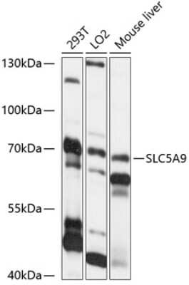 Western Blot: SLC5A9 AntibodyAzide and BSA Free [NBP2-95154]