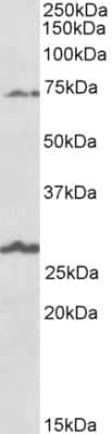 Western Blot: SLC6A12 Antibody [NBP2-26172]