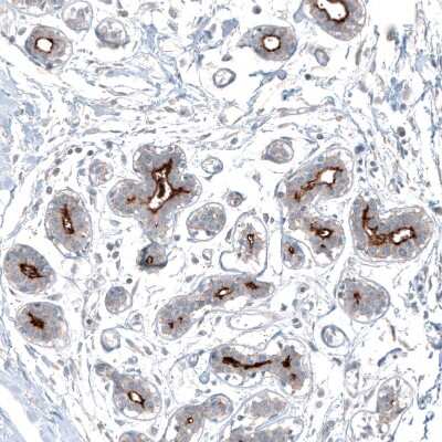 Immunohistochemistry-Paraffin: SLC6A14 Antibody [NBP1-86521]