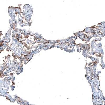 Immunohistochemistry-Paraffin: SLC6A14 Antibody [NBP1-86521]