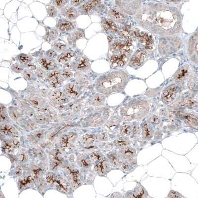 Immunohistochemistry-Paraffin: SLC6A14 Antibody [NBP1-86521]