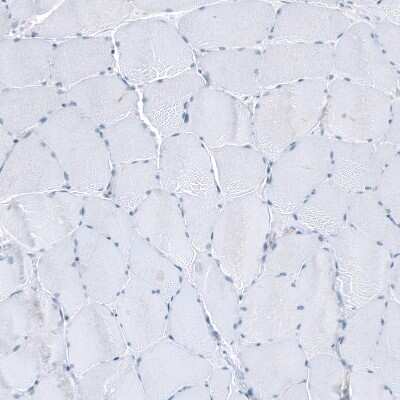 Immunohistochemistry-Paraffin: SLC6A14 Antibody [NBP1-86521]