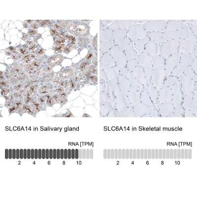 Immunohistochemistry-Paraffin: SLC6A14 Antibody [NBP1-86521]