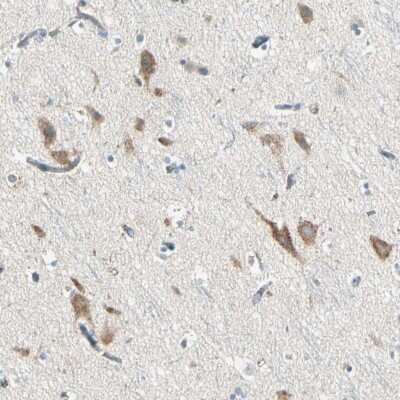 Immunohistochemistry-Paraffin: SLC6A15 Antibody [NBP1-83867]