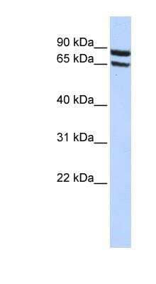 Western Blot: SLC6A15 Antibody [NBP1-59366]