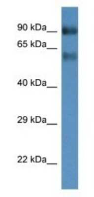 Western Blot: SLC6A15 Antibody [NBP1-74198]