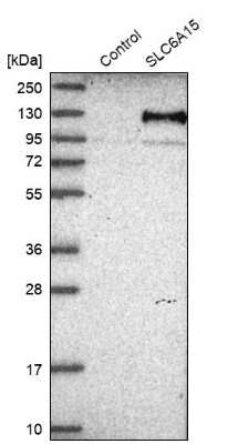 Western Blot: SLC6A15 Antibody [NBP1-83867]