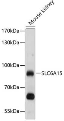 Western Blot: SLC6A15 AntibodyBSA Free [NBP2-93531]