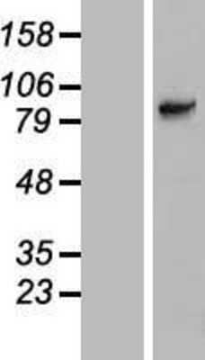 Western Blot: SLC6A15 Overexpression Lysate [NBL1-16179]