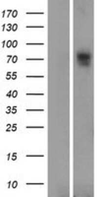 Western Blot: SLC6A16 Overexpression Lysate [NBP2-07387]