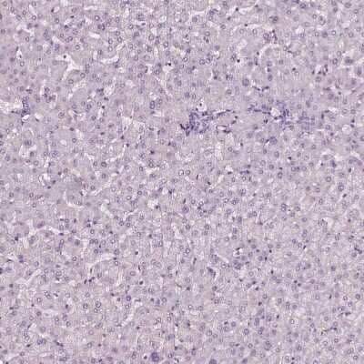 Immunohistochemistry-Paraffin: SLC6A17 Antibody [NBP1-86494]