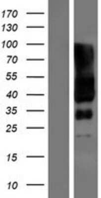 Western Blot: SLC6A17 Overexpression Lysate [NBP2-08770]