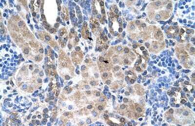 Immunohistochemistry-Paraffin: SLC6A18 Antibody [NBP1-59903]