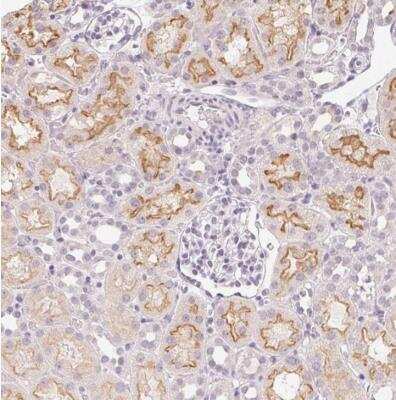Immunohistochemistry-Paraffin: SLC6A18 Antibody [NBP1-82024]