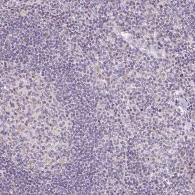 Immunohistochemistry-Paraffin: SLC6A18 Antibody [NBP1-82024]