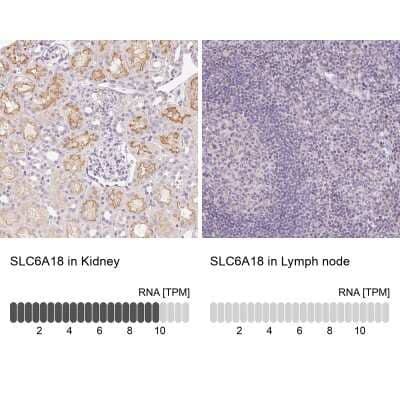 Immunohistochemistry-Paraffin: SLC6A18 Antibody [NBP1-82024]