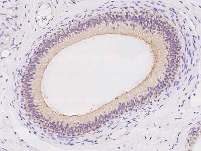 Immunohistochemistry-Paraffin: SLC6A18 Antibody [NBP2-97457]