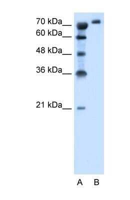 Western Blot: SLC6A18 Antibody [NBP1-59903]