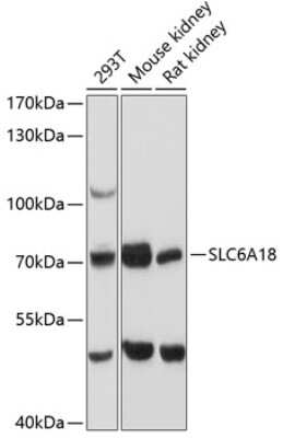 Western Blot: SLC6A18 AntibodyAzide and BSA Free [NBP2-93486]