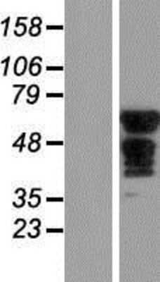 Western Blot: SLC6A18 Overexpression Lysate [NBP2-04823]