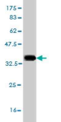 Western Blot: SLC6A19 Antibody (4F11) [H00340024-M01]