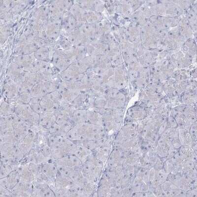 Immunohistochemistry-Paraffin: SLC6A19 Antibody [NBP1-86277]