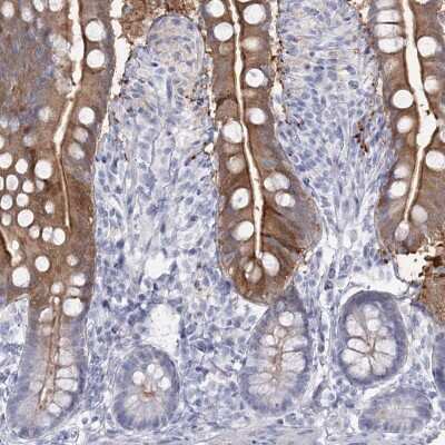 Immunohistochemistry-Paraffin: SLC6A19 Antibody [NBP1-86277]