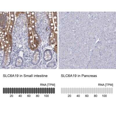 Immunohistochemistry-Paraffin: SLC6A19 Antibody [NBP1-86277]