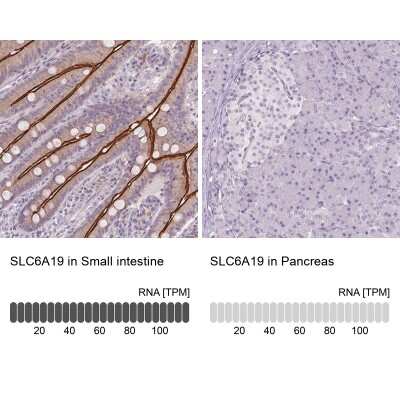 Immunohistochemistry-Paraffin: SLC6A19 Antibody [NBP2-48784]