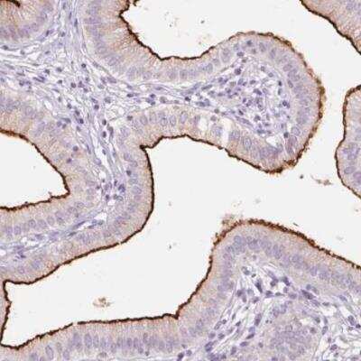 Immunohistochemistry-Paraffin: SLC6A19 Antibody [NBP2-48784]