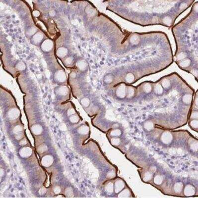 Immunohistochemistry-Paraffin: SLC6A19 Antibody [NBP2-48784]