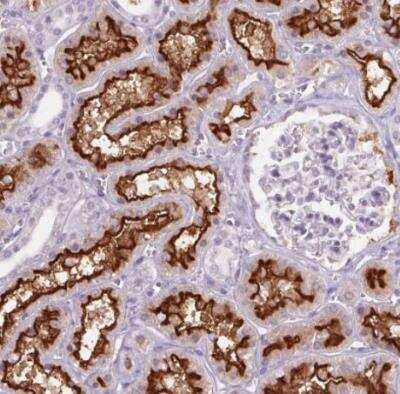 Immunohistochemistry-Paraffin: SLC6A19 Antibody [NBP2-48784]