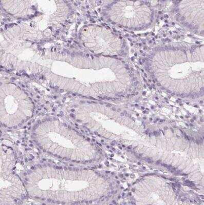 Immunohistochemistry-Paraffin: SLC6A19 Antibody [NBP2-48784]