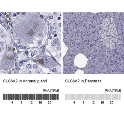 Immunohistochemistry-Paraffin: SLC6A2/NET/Noradrenaline transporter Antibody [NBP2-62704]