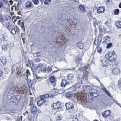 Immunohistochemistry-Paraffin: SLC6A2/NET/Noradrenaline transporter Antibody [NBP2-62704]