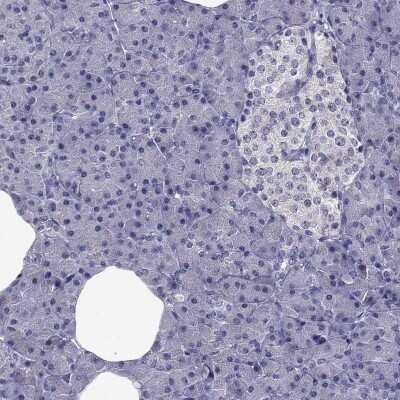 Immunohistochemistry-Paraffin: SLC6A2/NET/Noradrenaline transporter Antibody [NBP2-62704]