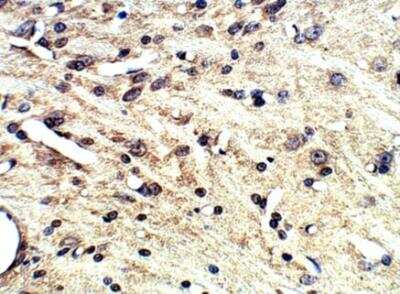 Immunohistochemistry-Paraffin: SLC6A2/NET/Noradrenaline transporter Antibody [NBP3-12251]
