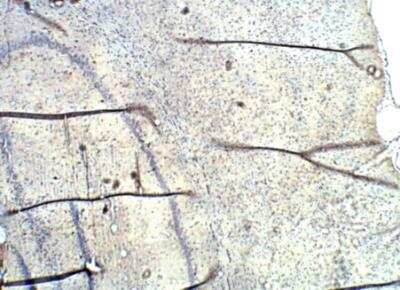 Immunohistochemistry-Paraffin: SLC6A2/NET/Noradrenaline transporter Antibody [NBP3-12251]