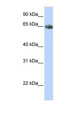 Western Blot: SLC6A2/NET/Noradrenaline transporter Antibody [NBP1-60120]