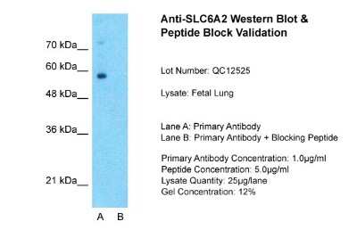 Western Blot: SLC6A2/NET/Noradrenaline transporter Antibody [NBP1-60120]