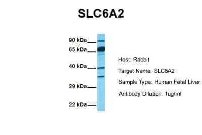 Western Blot: SLC6A2/NET/Noradrenaline transporter Antibody [NBP1-60120]