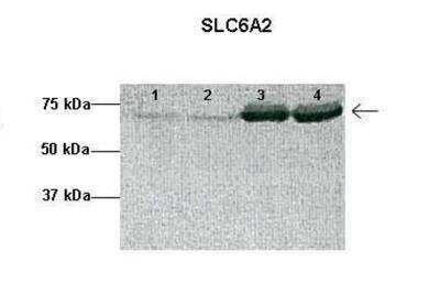 Western Blot: SLC6A2/NET/Noradrenaline transporter Antibody [NBP2-85762]